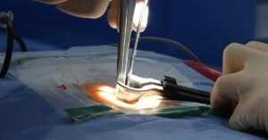 learn about spinal stenosis, a condition characterized by the narrowing of the spinal canal, leading to potential nerve compression. explore symptoms, causes, treatment options, and tips for managing this condition effectively.