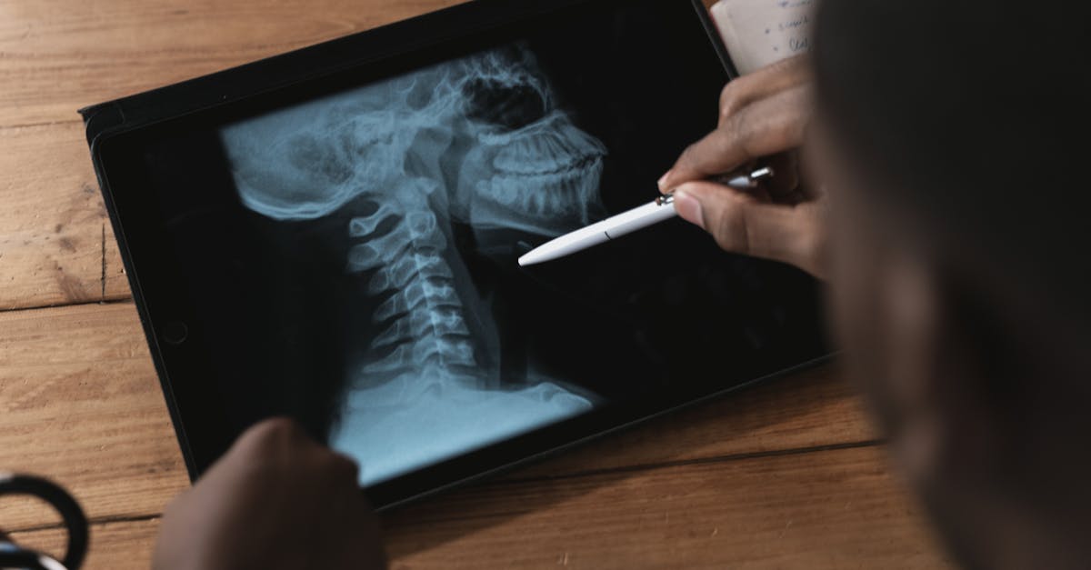 discover effective tips to alleviate tech neck discomfort caused by prolonged screen time. learn postures, exercises, and ergonomic adjustments to maintain neck health in today's digital age.