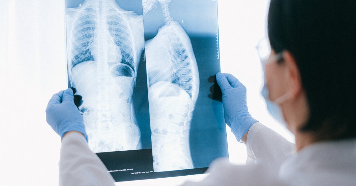 discover effective strategies for understanding and managing thoracic spine pain. explore causes, symptoms, and treatment options to relieve discomfort and improve your quality of life.