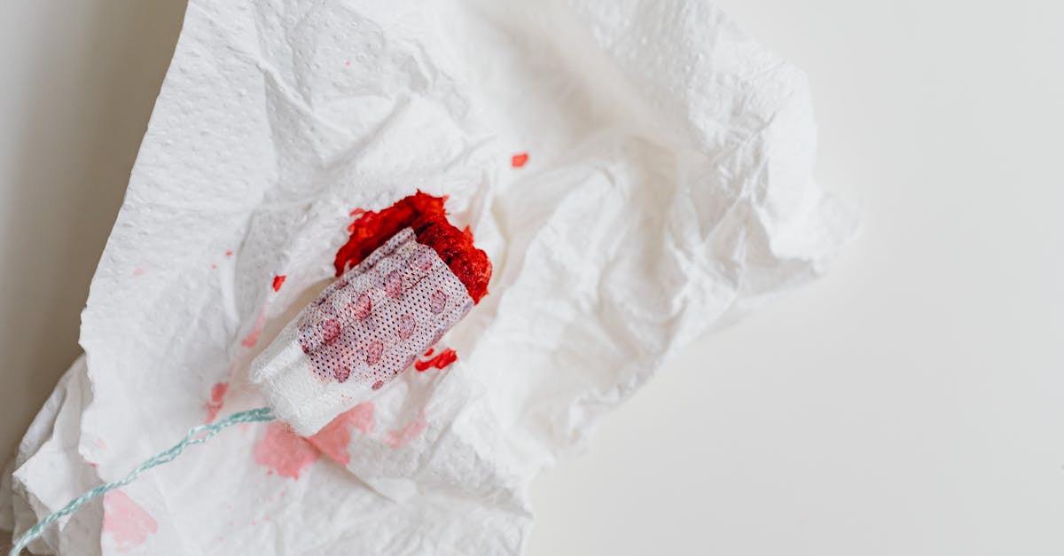 explore the connection between menstrual cycles and migraines. discover effective strategies for managing menstrual migraines, including lifestyle changes, remedies, and expert advice to alleviate discomfort during your period.