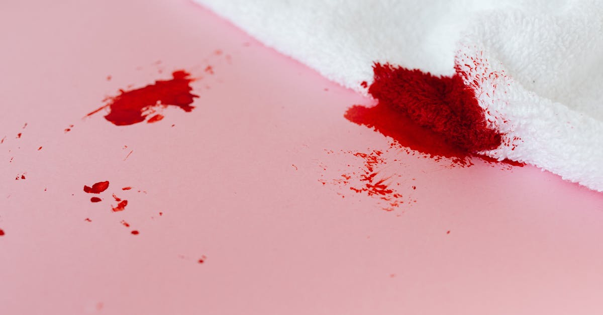 discover effective strategies for managing menstrual migraines, including causes, symptoms, and treatments tailored for women. empower yourself with knowledge to alleviate pain and improve your quality of life during your cycle.