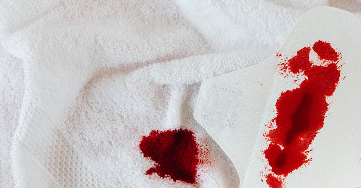 discover the connection between menstrual migraines and hormonal changes in our comprehensive guide. learn about causes, symptoms, and effective management strategies to alleviate pain during your menstrual cycle.
