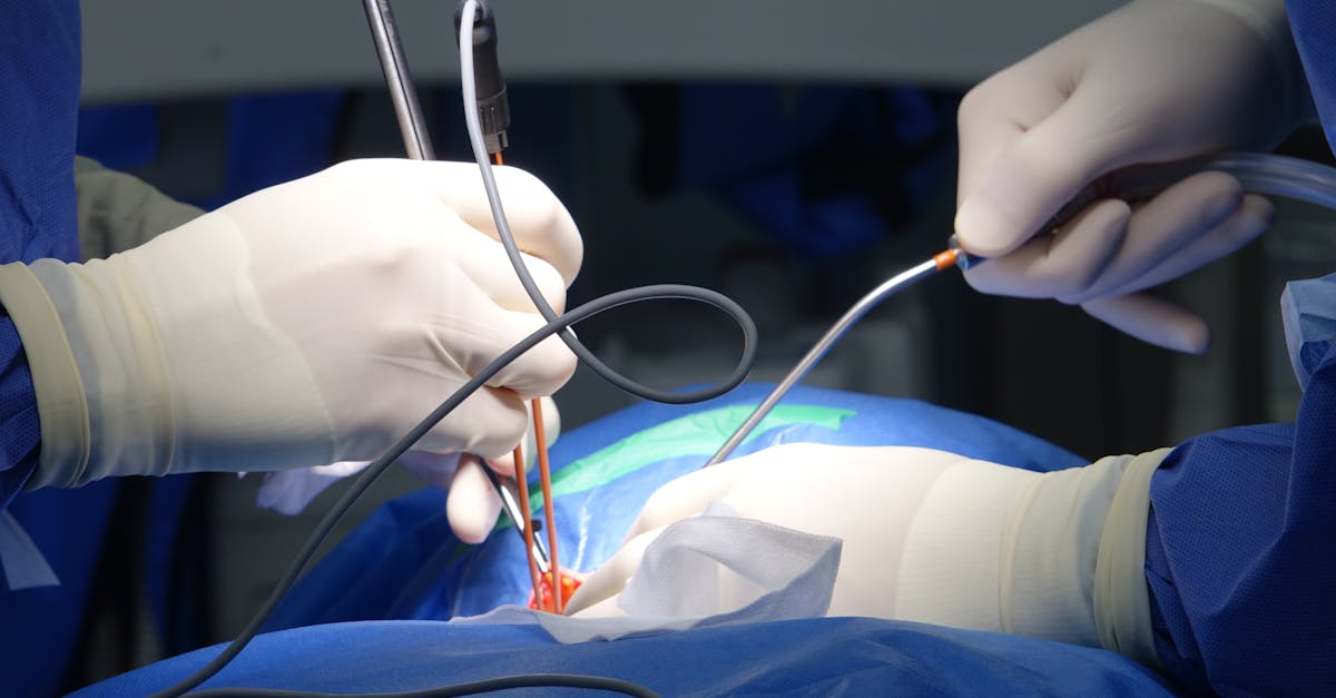 discover effective treatment options and insights for spinal stenosis, a condition characterized by narrowing of the spinal canal that can lead to pain and mobility issues. explore causes, symptoms, and management strategies to improve your quality of life.