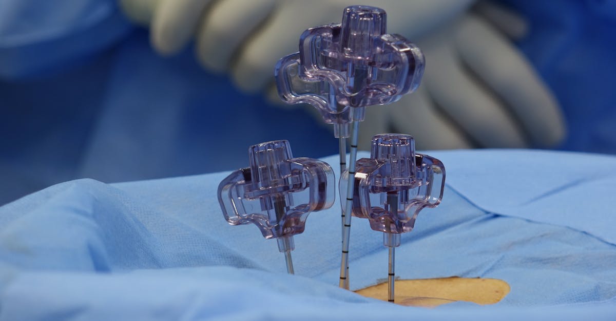 discover essential insights about spinal stenosis, its symptoms, causes, and effective treatment options. learn how to manage this condition for improved mobility and quality of life.