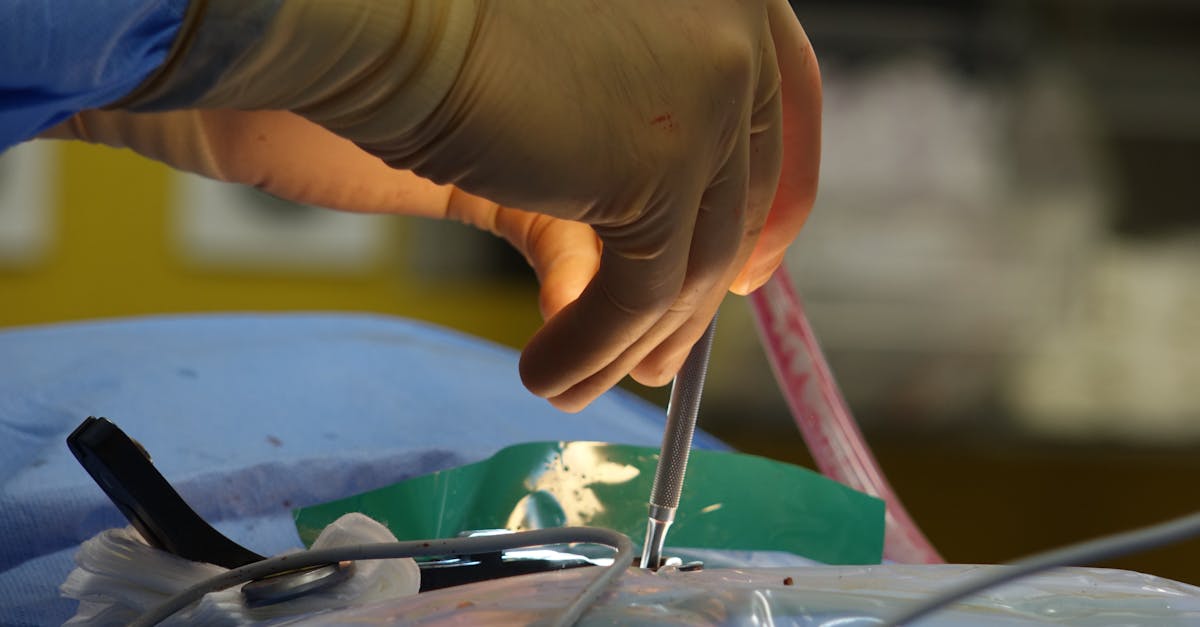 learn about spinal stenosis, its causes, symptoms, and treatment options. discover how this condition affects the spine and what you can do to manage pain and improve mobility.