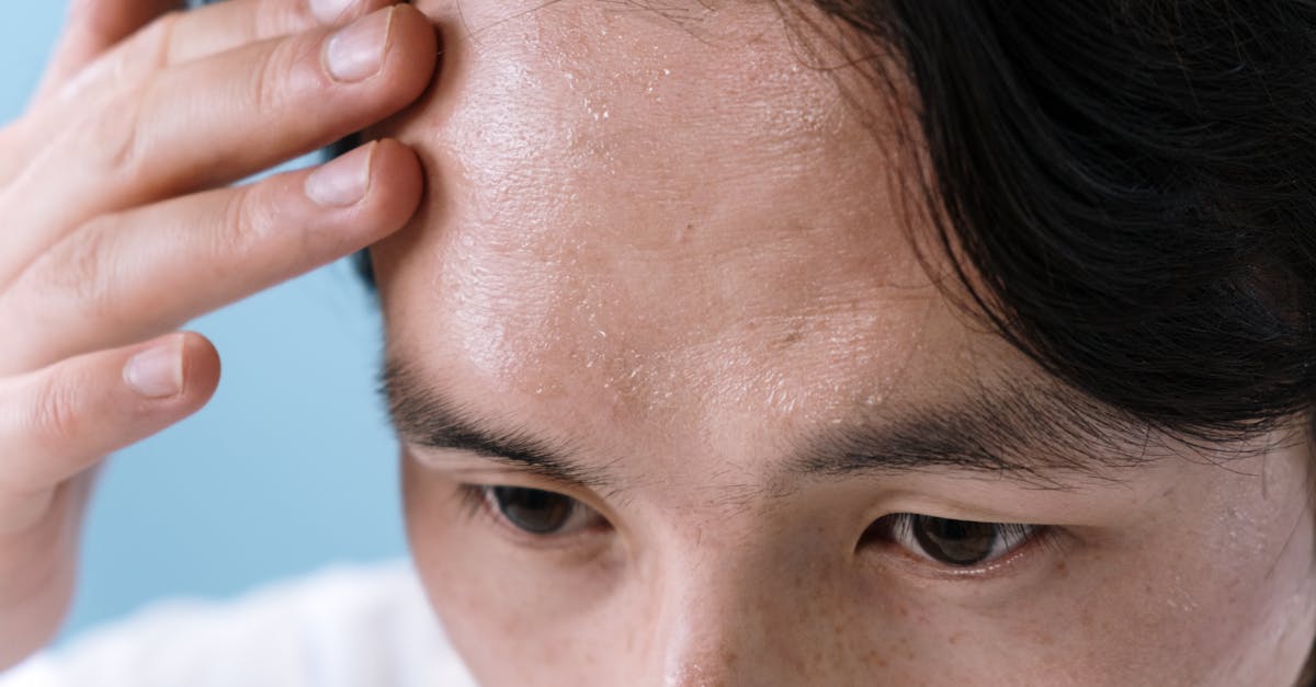 discover effective solutions for tension headaches and learn about their causes. find relief through tips, treatments, and prevention strategies to help you manage and reduce the impact of these common headaches.