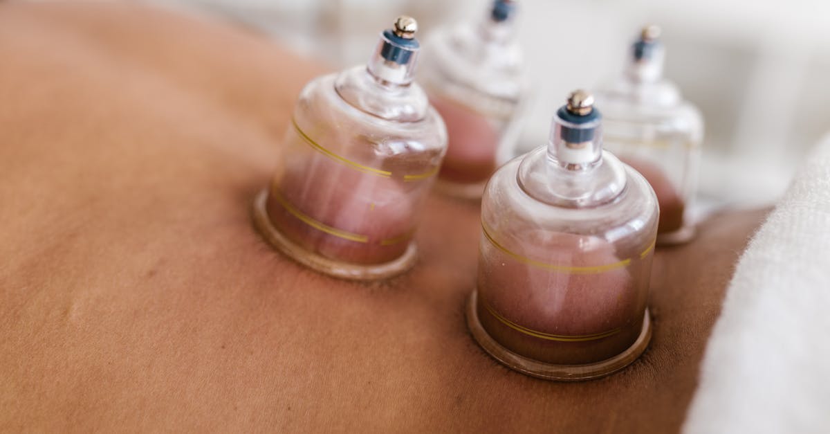discover effective solutions and insights for alleviating upper back pain. learn about causes, treatments, and preventative measures to help you regain comfort and mobility.