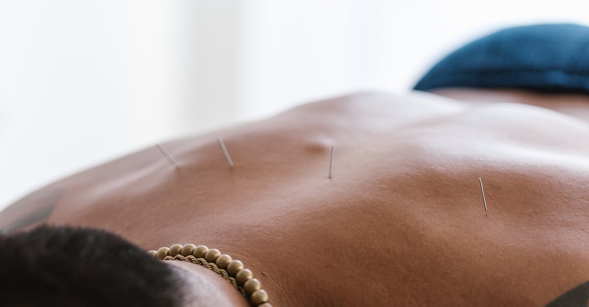 discover effective strategies to relieve upper back pain and improve your posture. learn about common causes, treatment options, and preventative measures to enhance your overall well-being.
