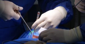 learn about herniated discs, including causes, symptoms, treatment options, and ways to manage back pain. find expert advice and helpful resources.